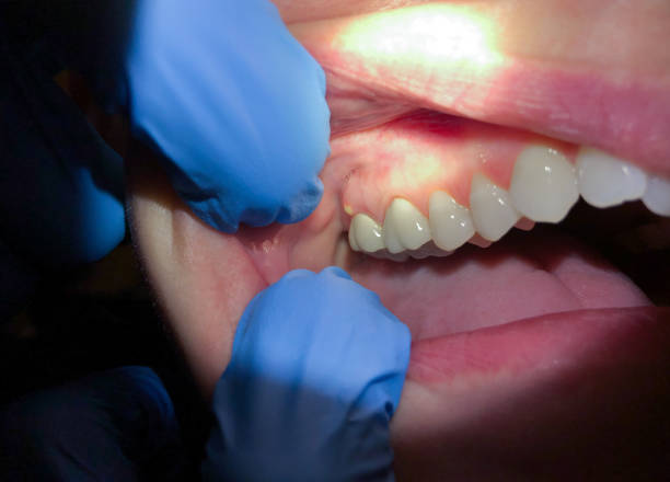 Best Emergency Gum Pain Relief  in Duson, LA