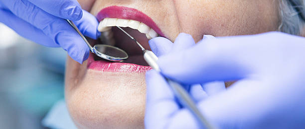 Best Knocked-Out Tooth Emergency  in Duson, LA